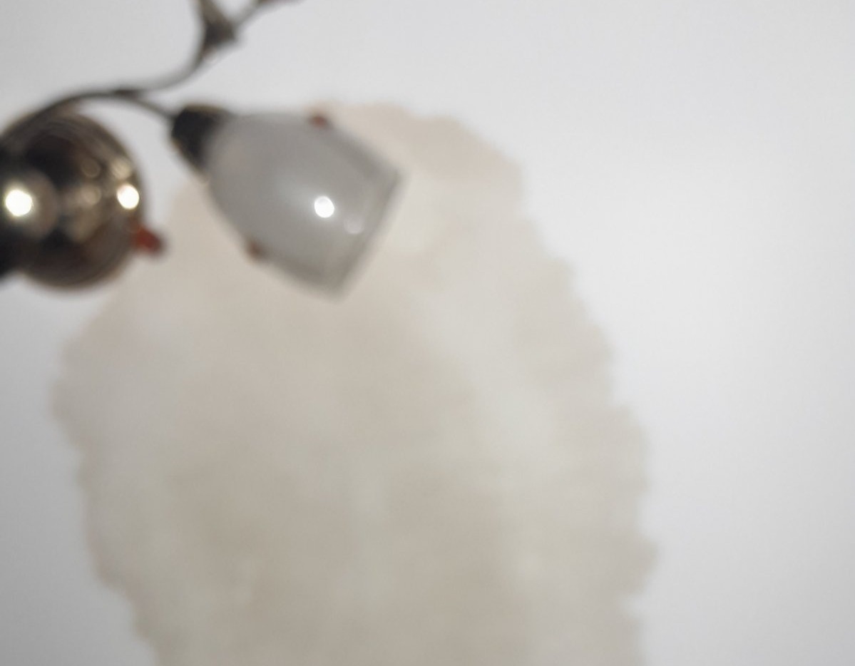 В результаті обстрілу жінка з Білопілля втратила слух