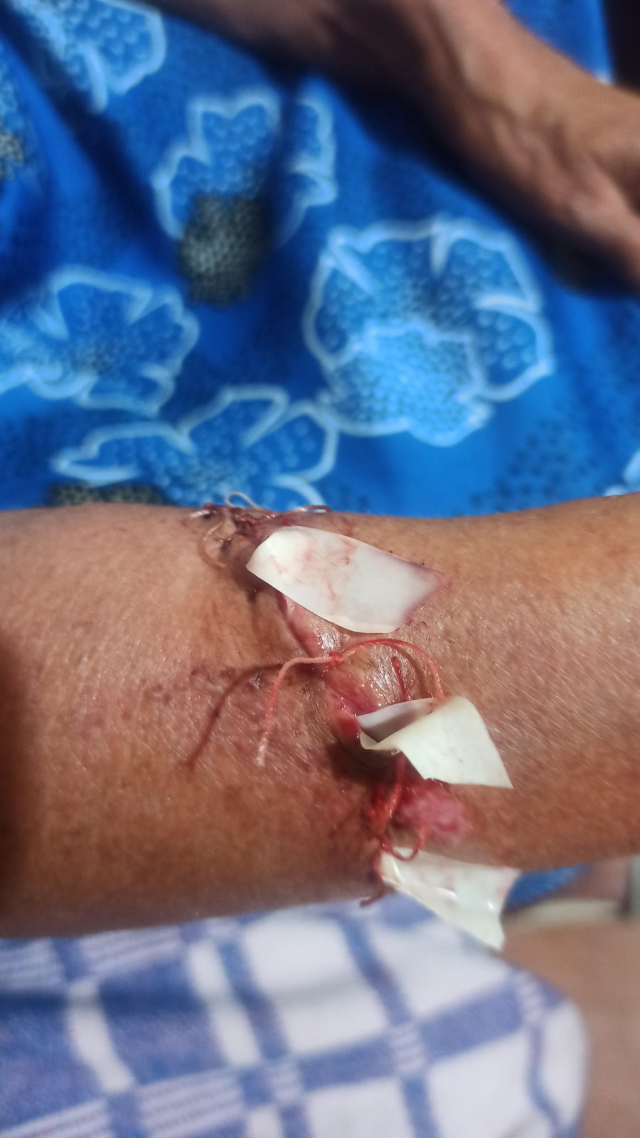 Пенсіонерку із Сумщини було поранено під час обстрілу її будинку